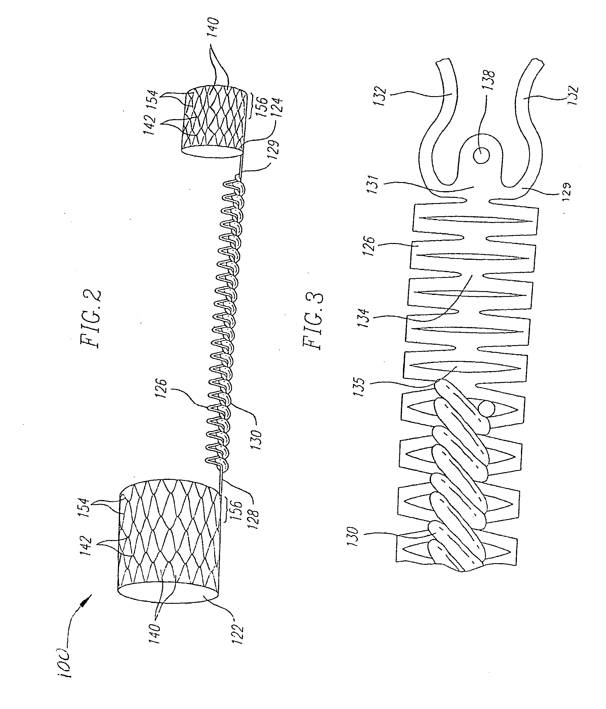 Anchoring system for medical implant