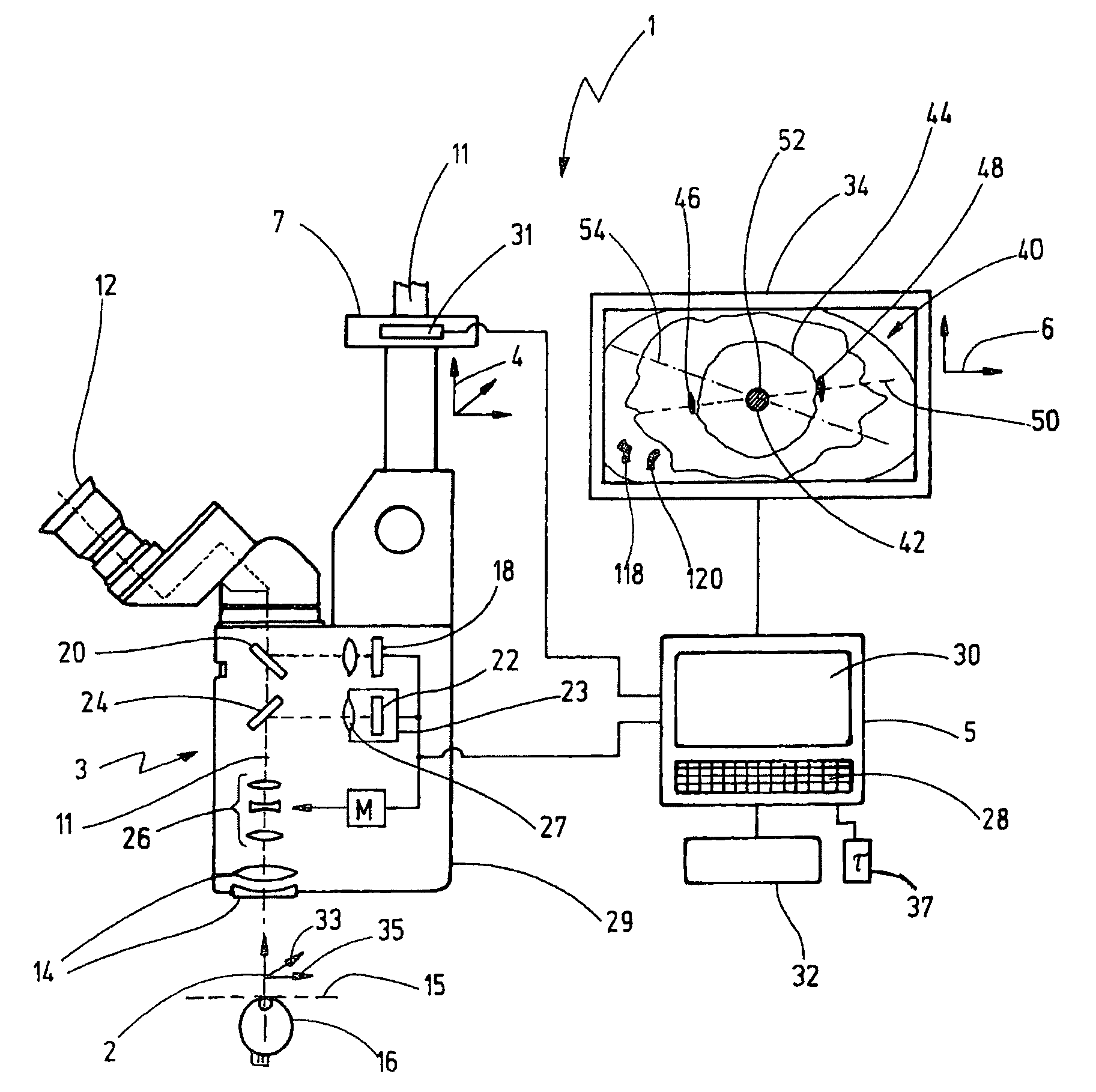 Microscopy system for eye surgery