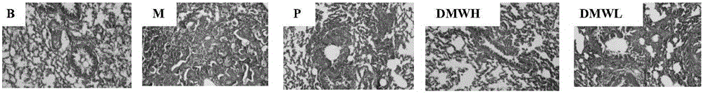 Application of demethylwedelolactone to preparation of medicine for resisting pulmonary fibrosis