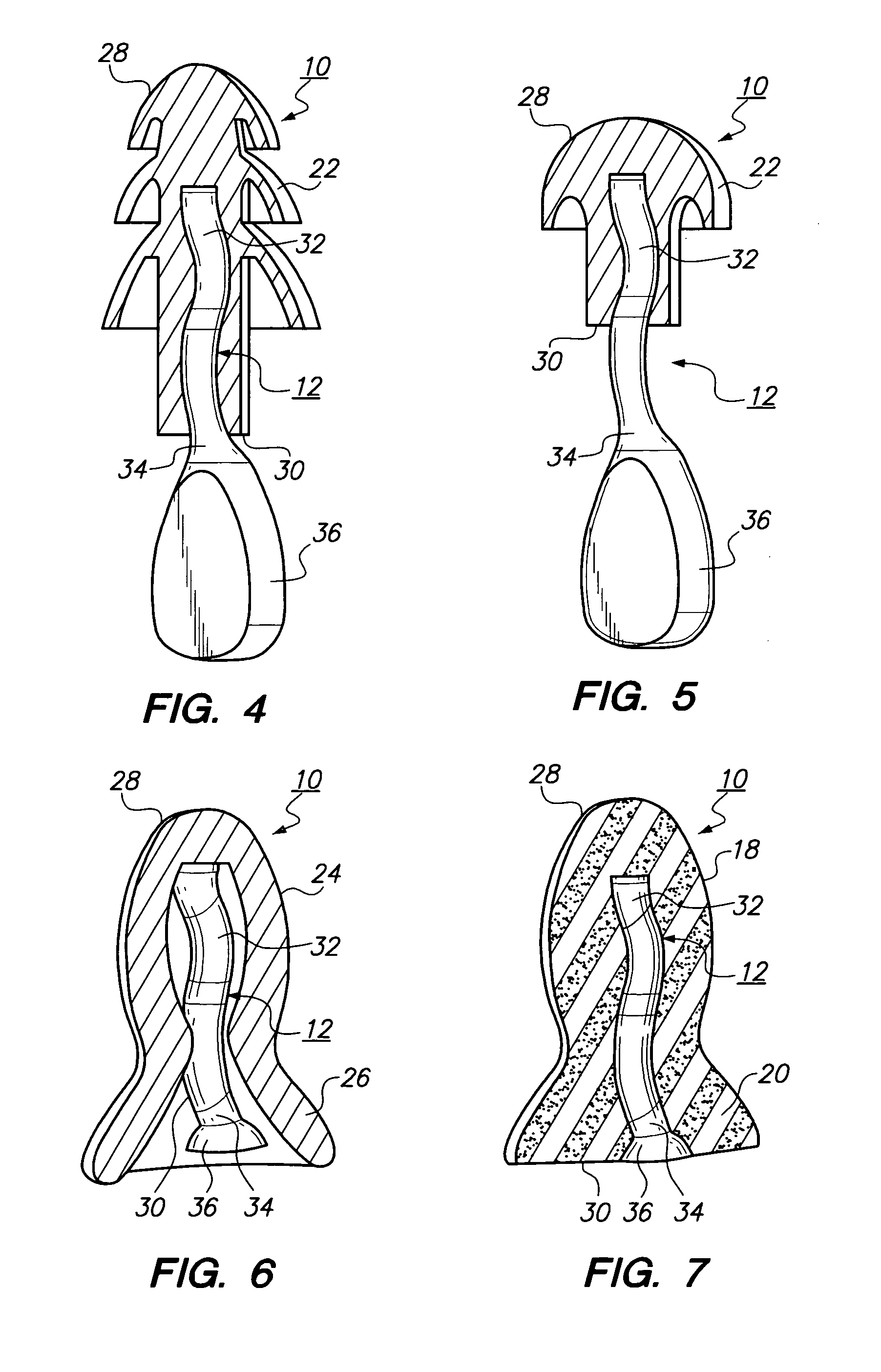 Push-in type of earplug with improved insertion stem