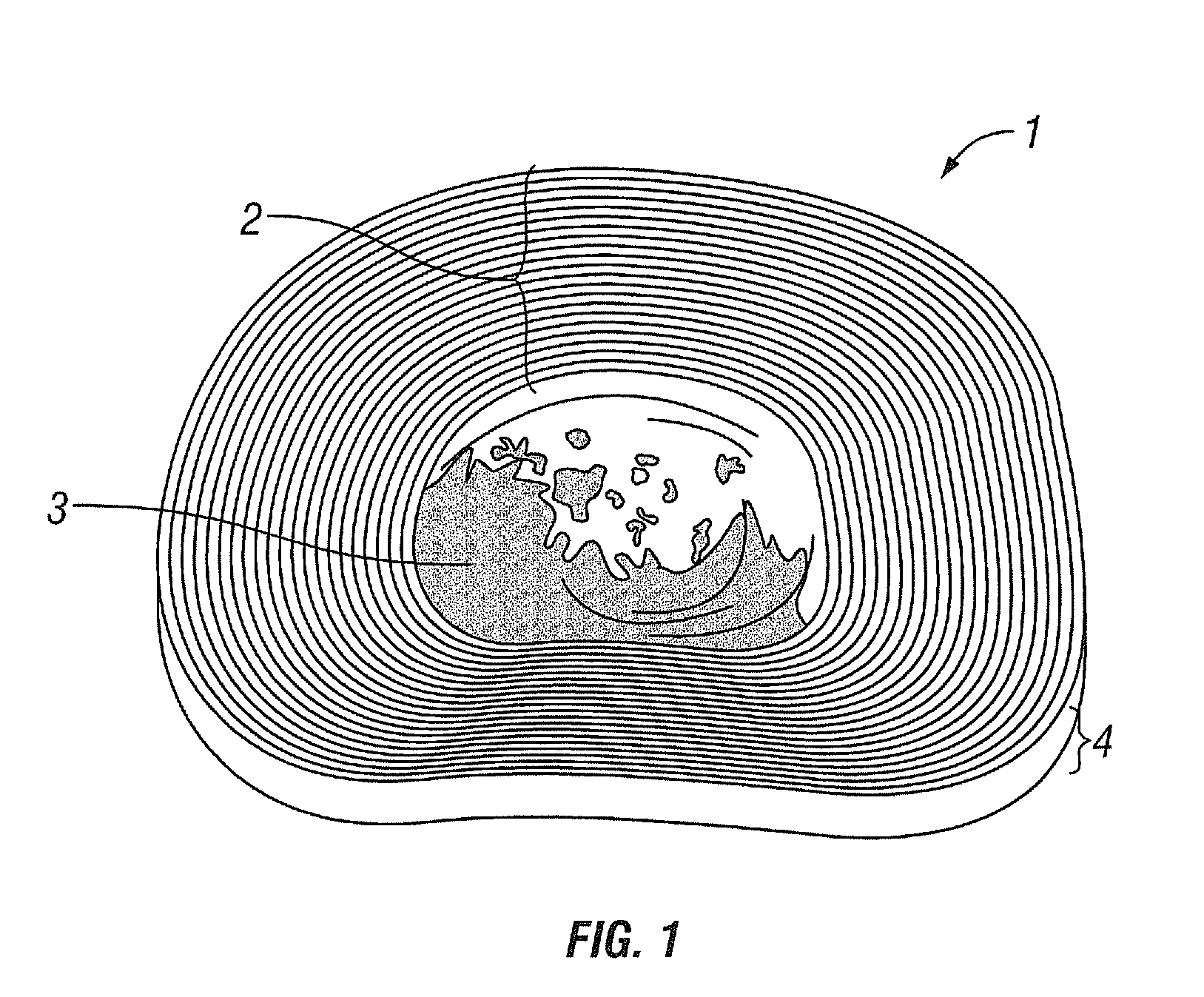 Expandable Spacer and Method For Use Thereof