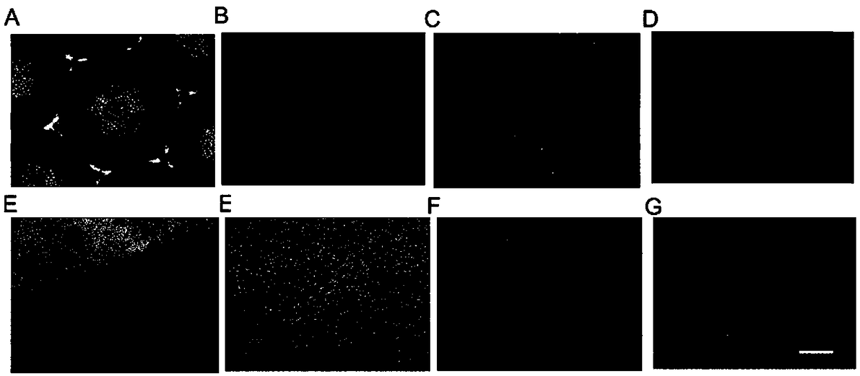 Method for generating autologous melanocytes based on 3D suspension iPS (induced pluripotent stem cells) and application