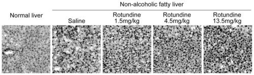 Application of rotundine in preparation of medicine for treating fatty liver