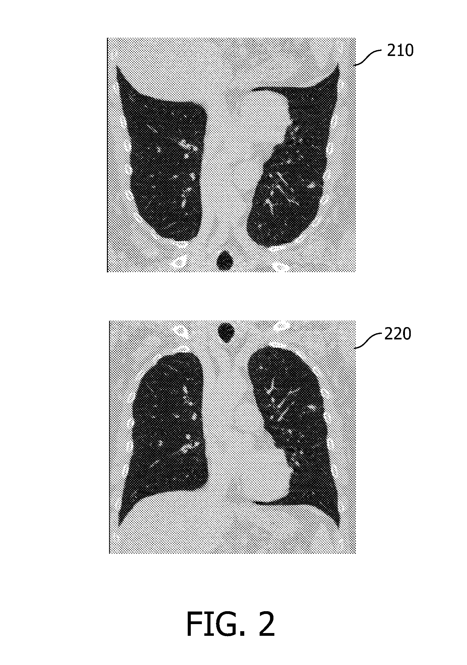 Method of automatically correcting mis-orientation of medical images