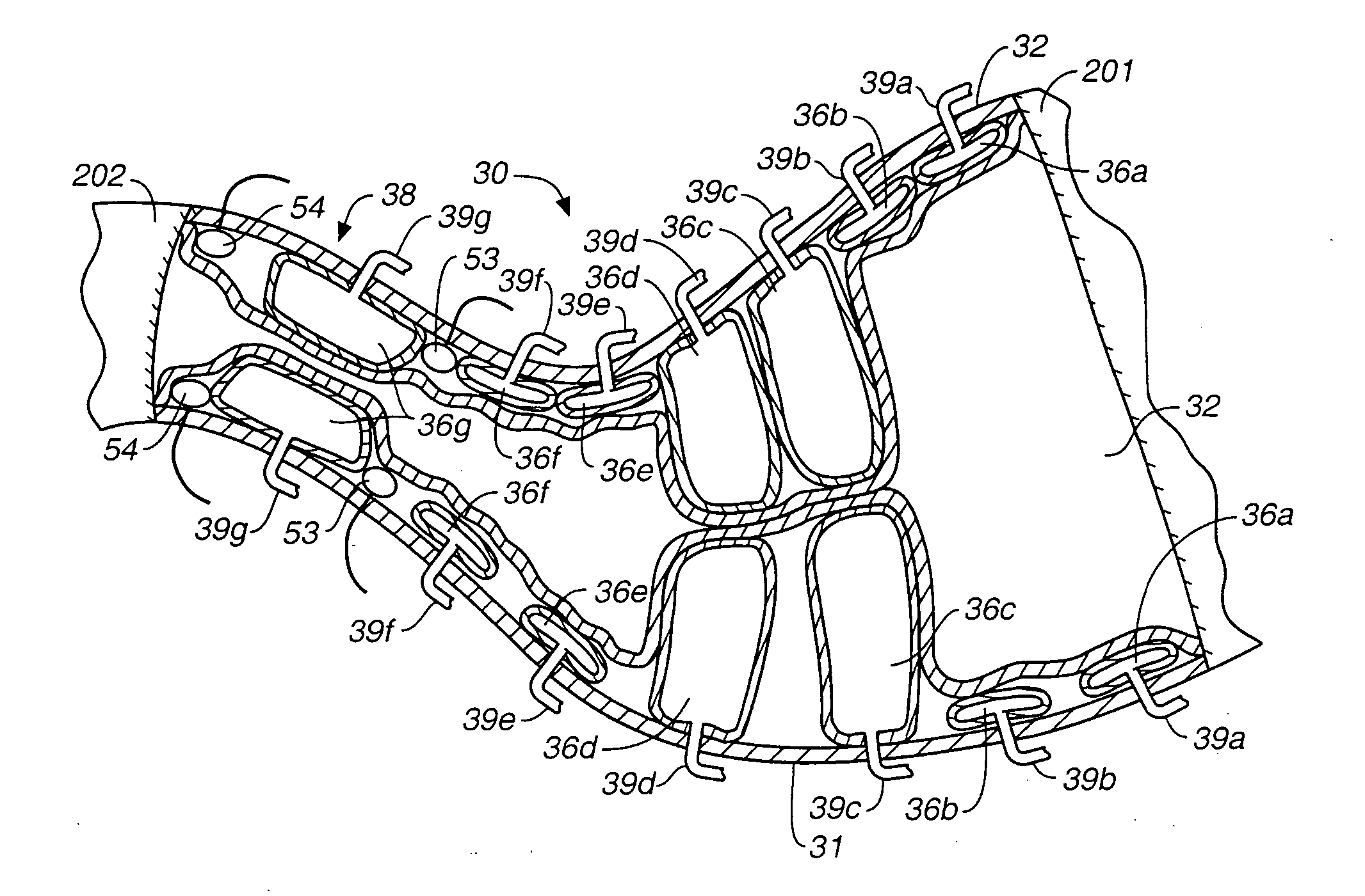 Stomach peristalsis device and method