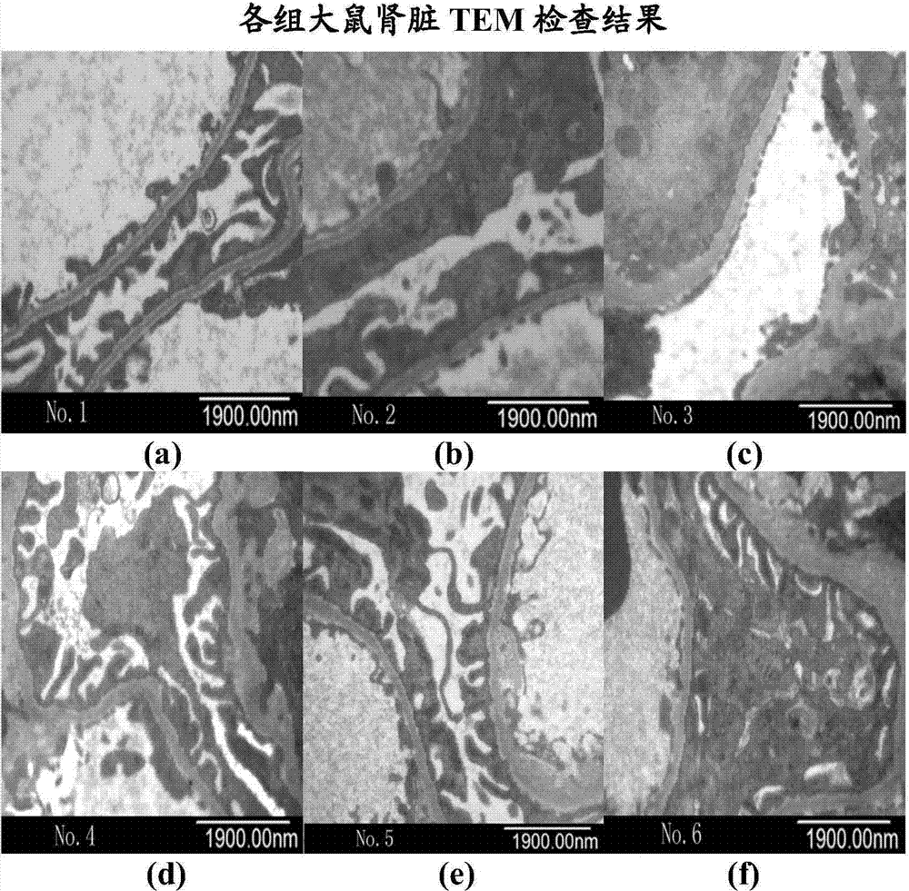 Albumin-containing pharmaceutical composition and application thereof