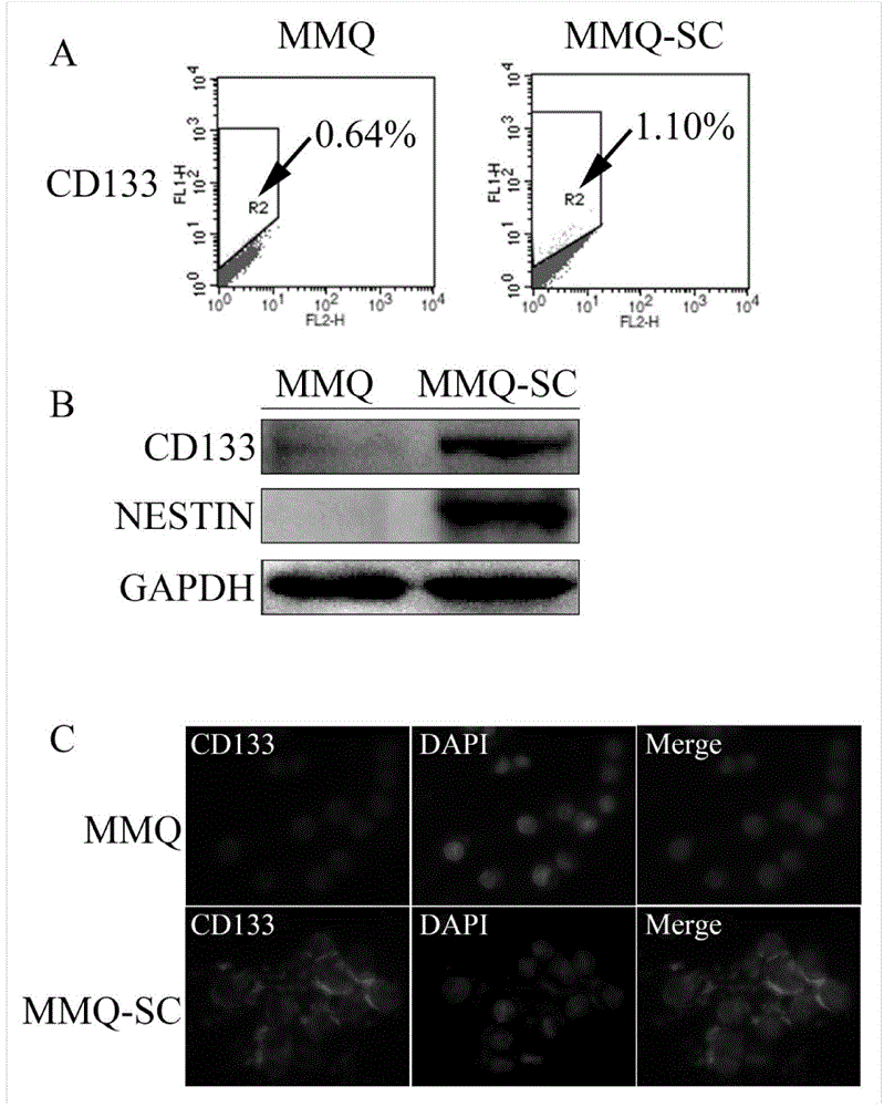 Culture method of tumor stem-cell-like cells of rat pituitary prolactinoma cell strain