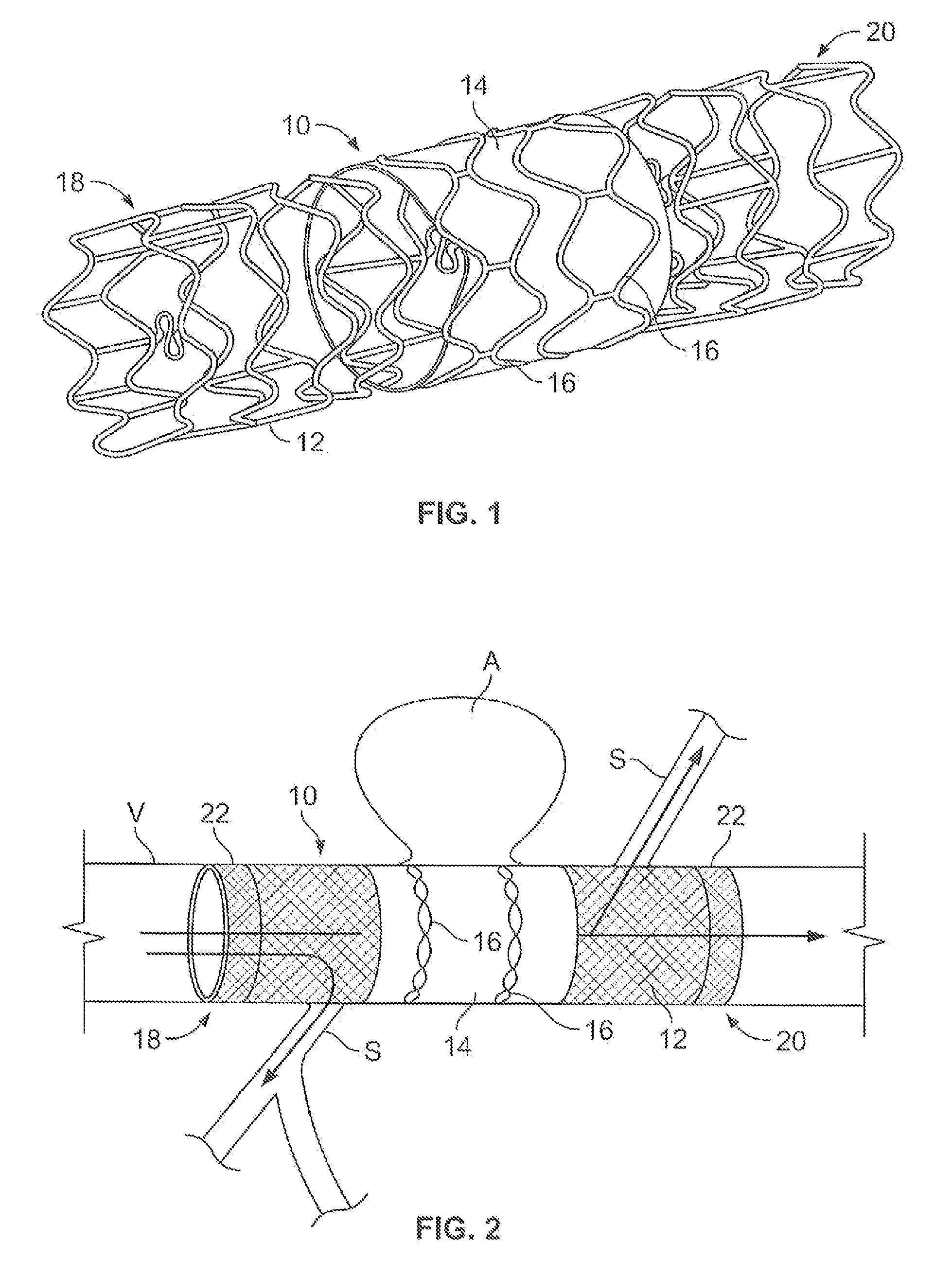 Partially covered stent devices and methods of use