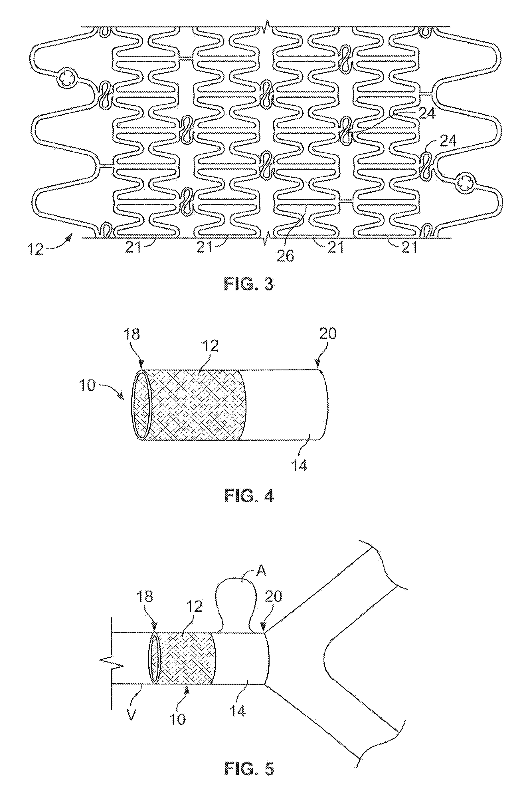 Partially covered stent devices and methods of use