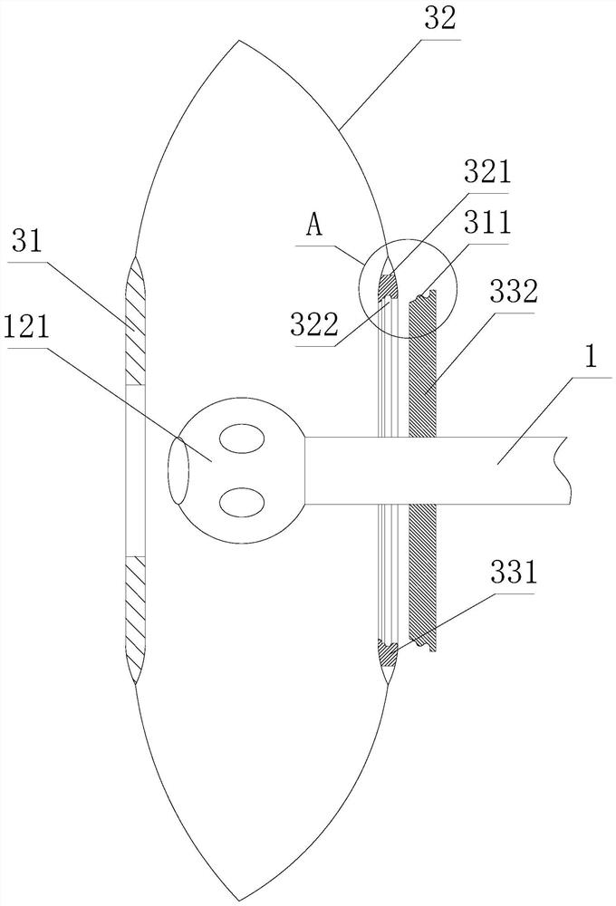 Direct-connection type intestinal juice back-conveying device