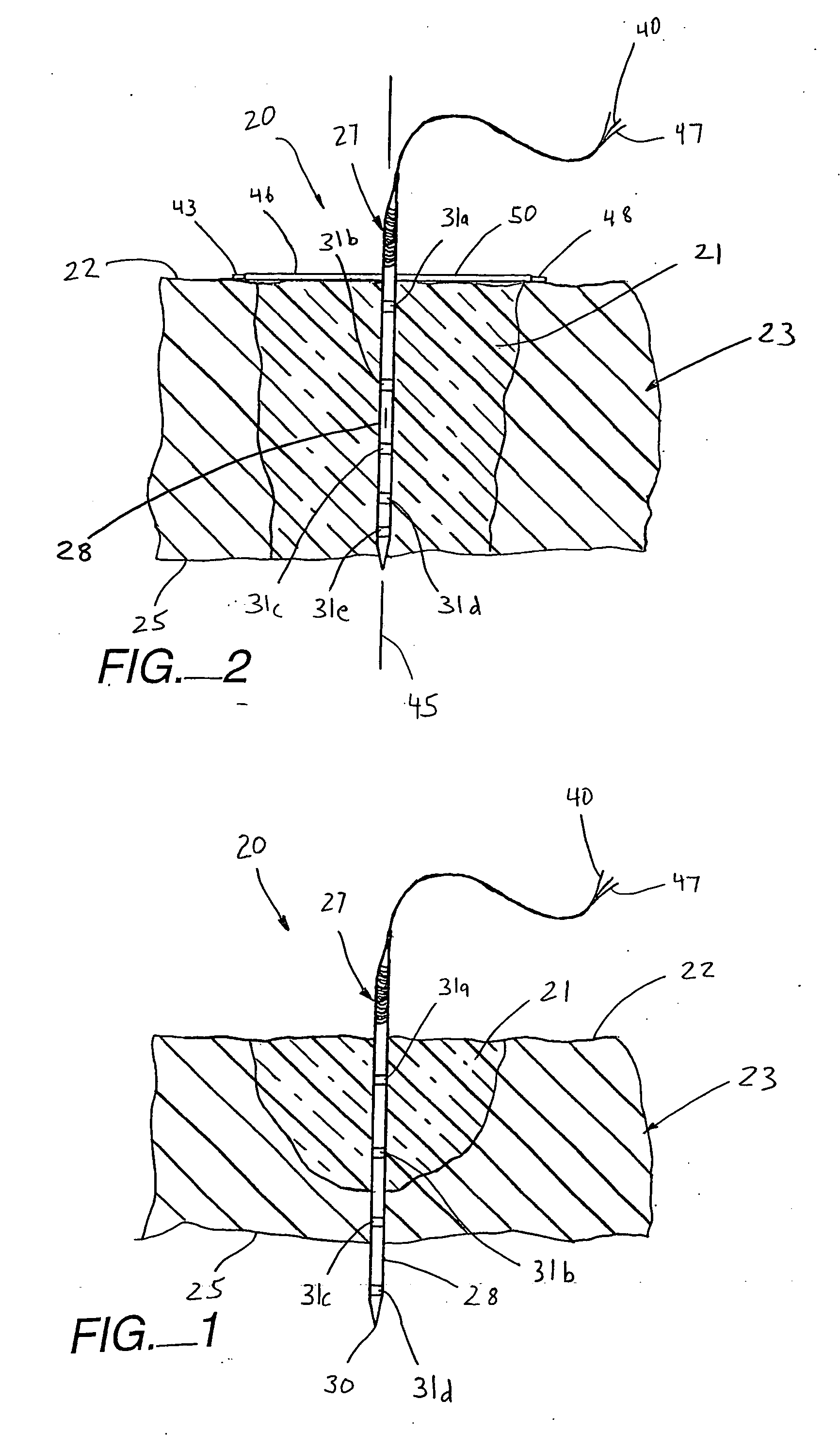 Apparatus and method for assessing tissue ablation transmurality