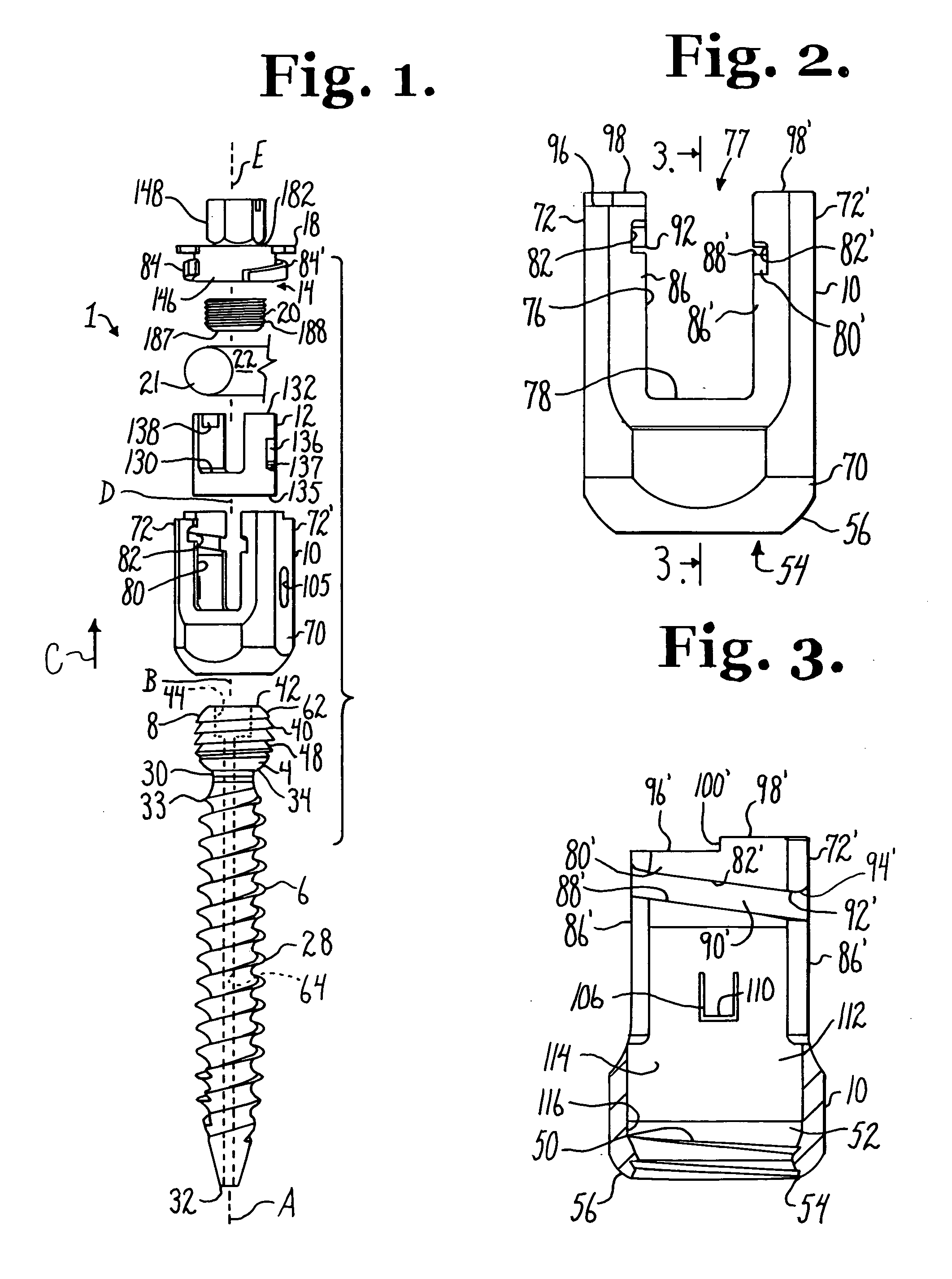 Polyaxial bone anchor with helical capture connection, insert and dual locking assembly