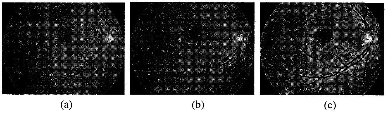 Retina three-dimensional reconstruction method based on multiple fundus images without camera calibration