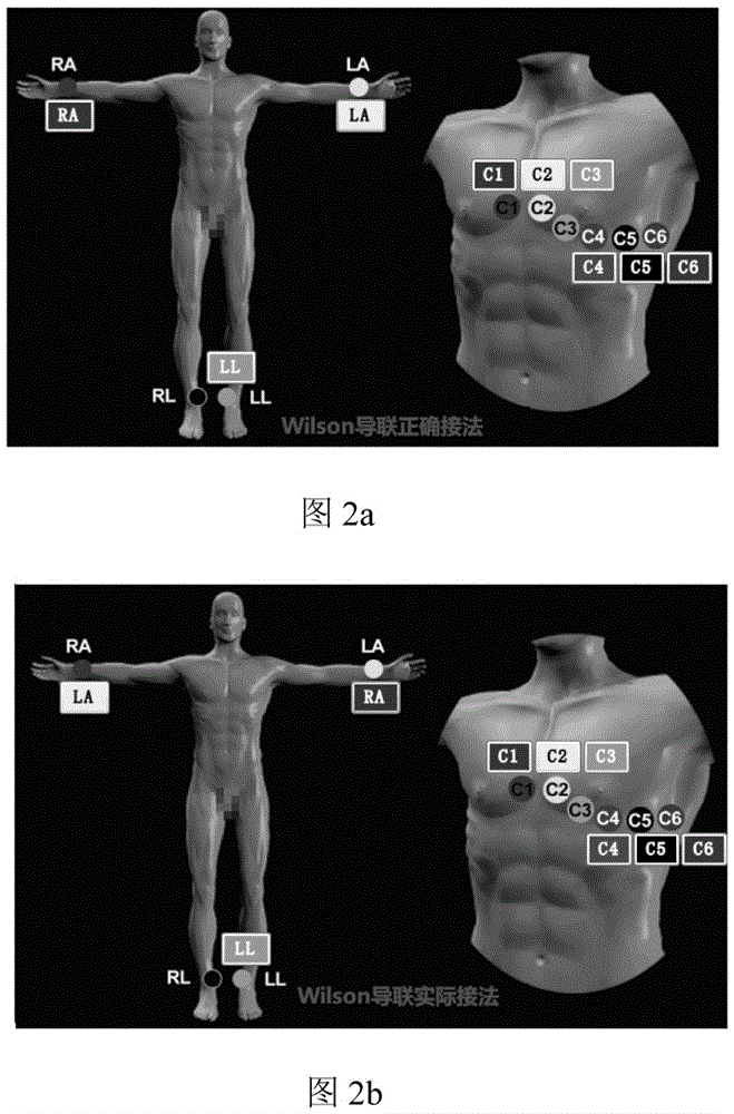 A Correction Method for Electrocardiogram Lead Misconnection