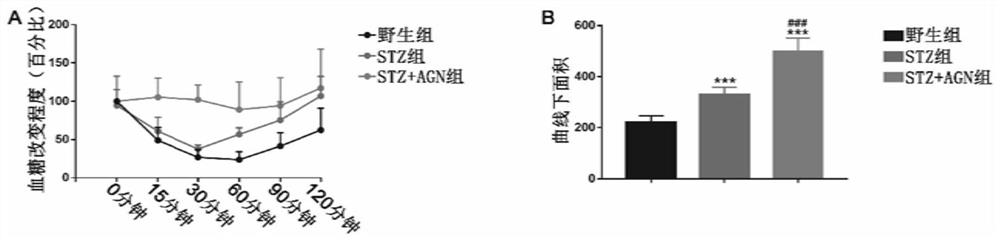 A method for constructing a type 2 diabetic mouse model of rapid heart failure