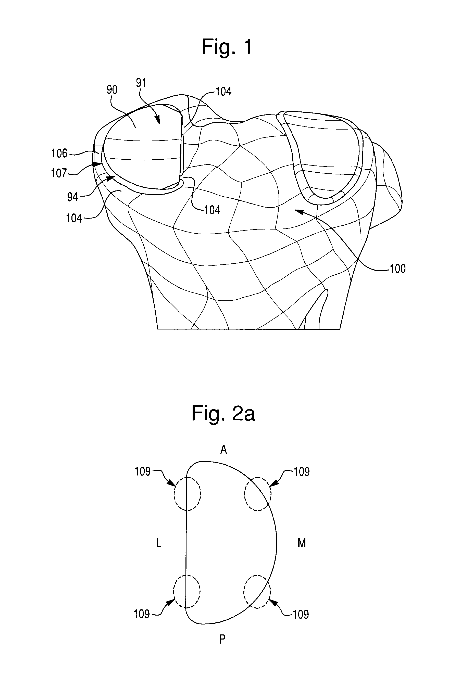 Prosthetic device, method of planning bone removal for implantation of prosthetic device, and robotic system