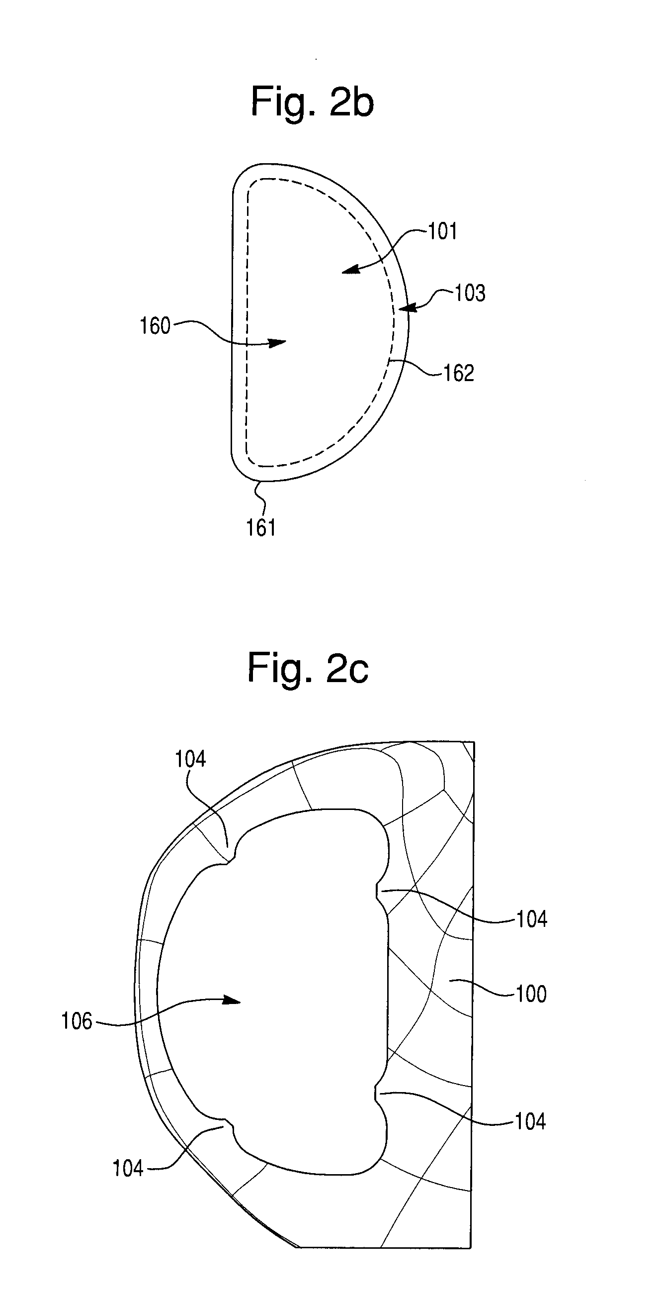 Prosthetic device, method of planning bone removal for implantation of prosthetic device, and robotic system
