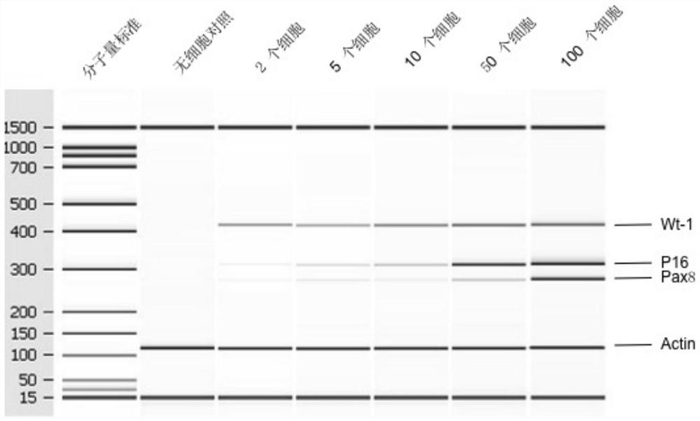 A kit for detecting markers of ovarian cancer cells in peripheral blood