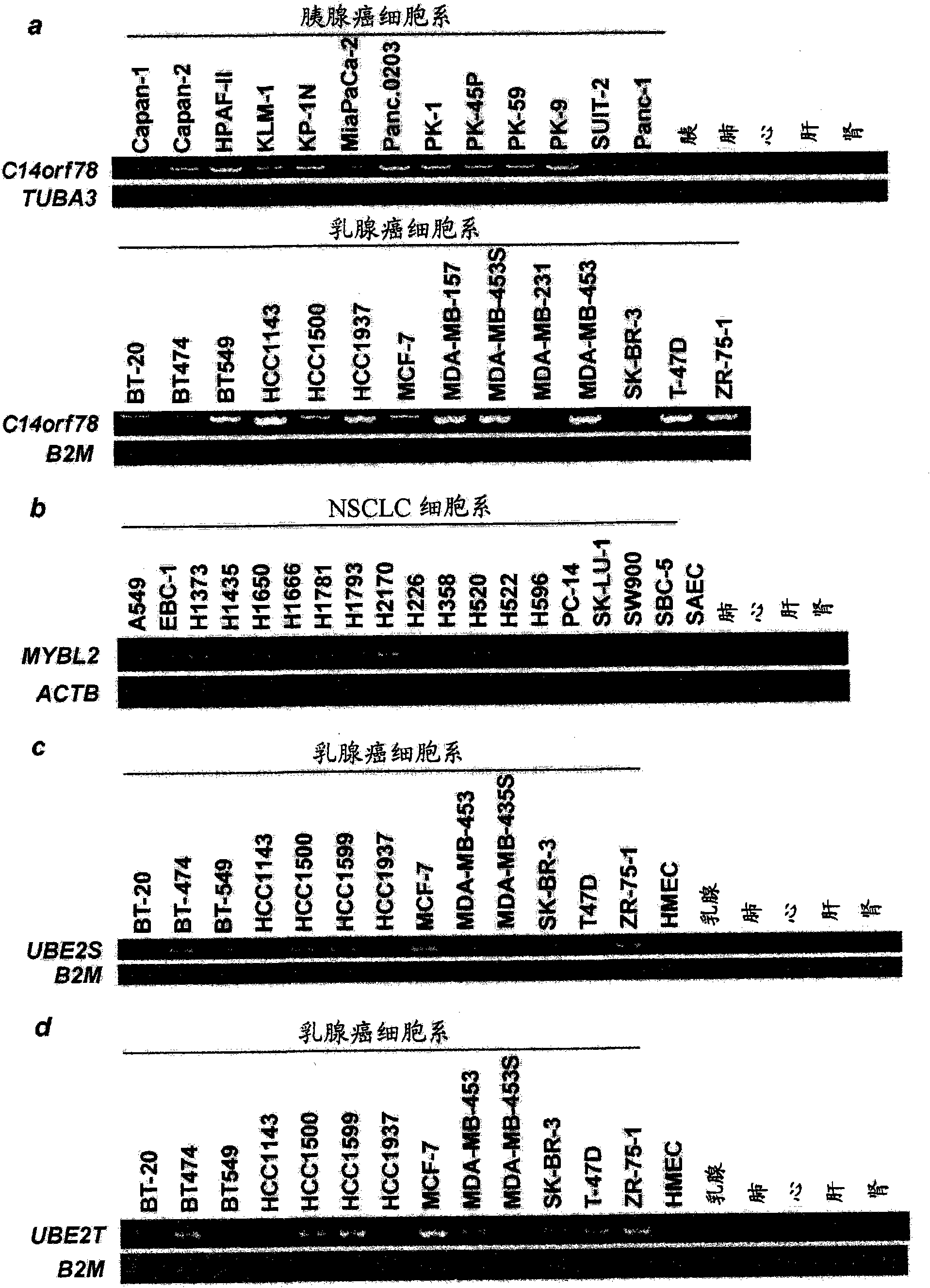 Compositions and methods of treating cancer