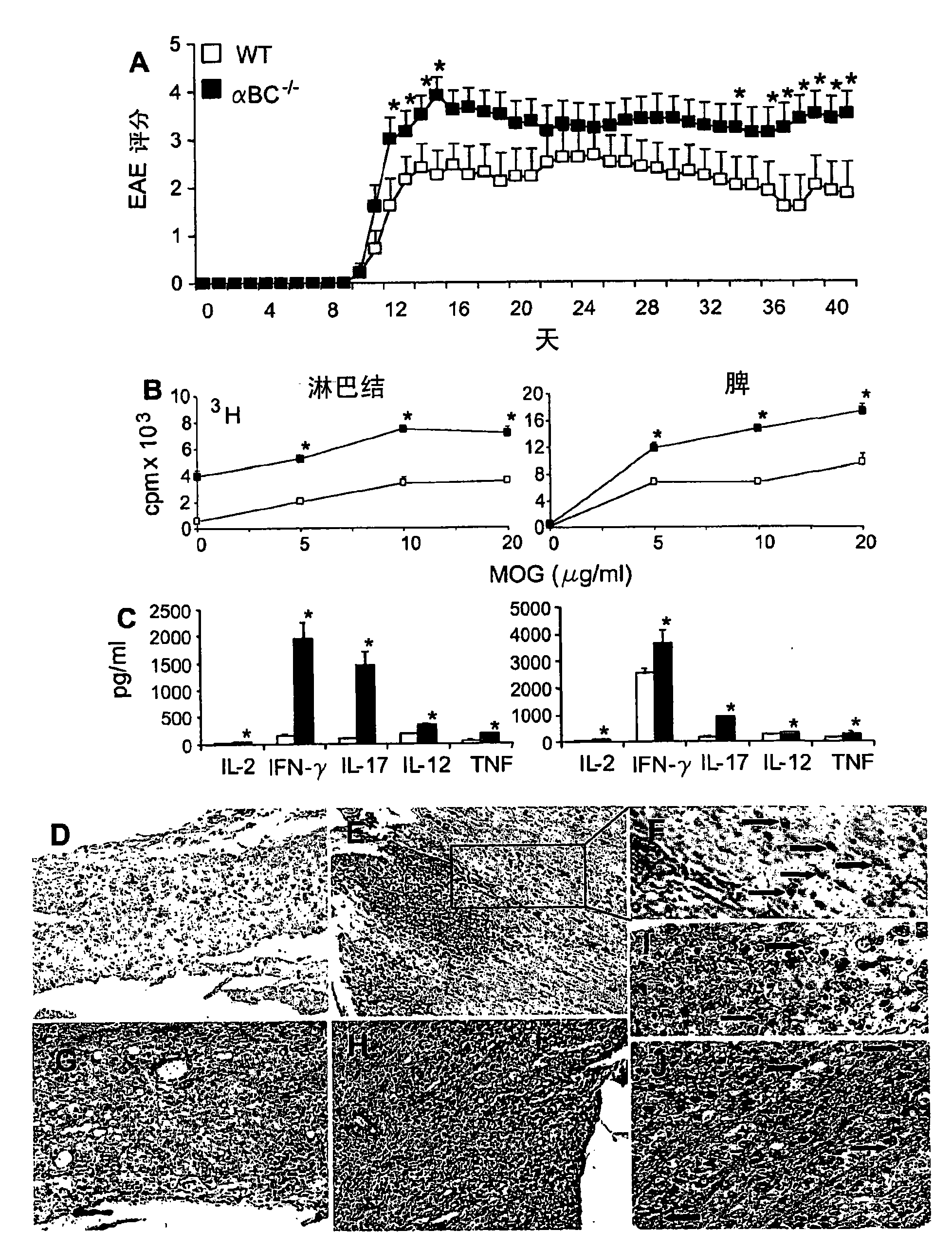 Alpha b-crystallin as a therapy for inflammation