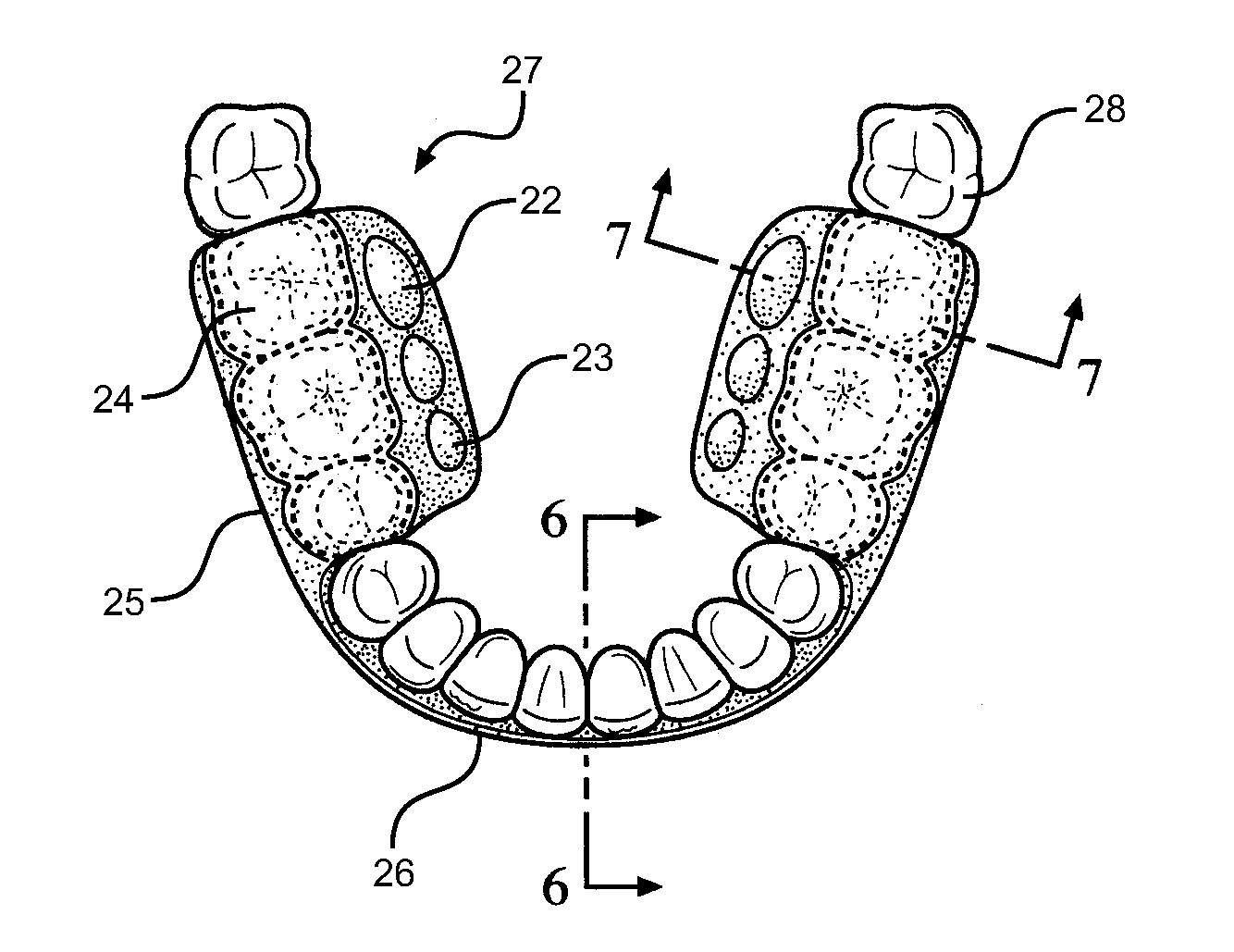 P3 Personal Power and Performance Mouthpiece