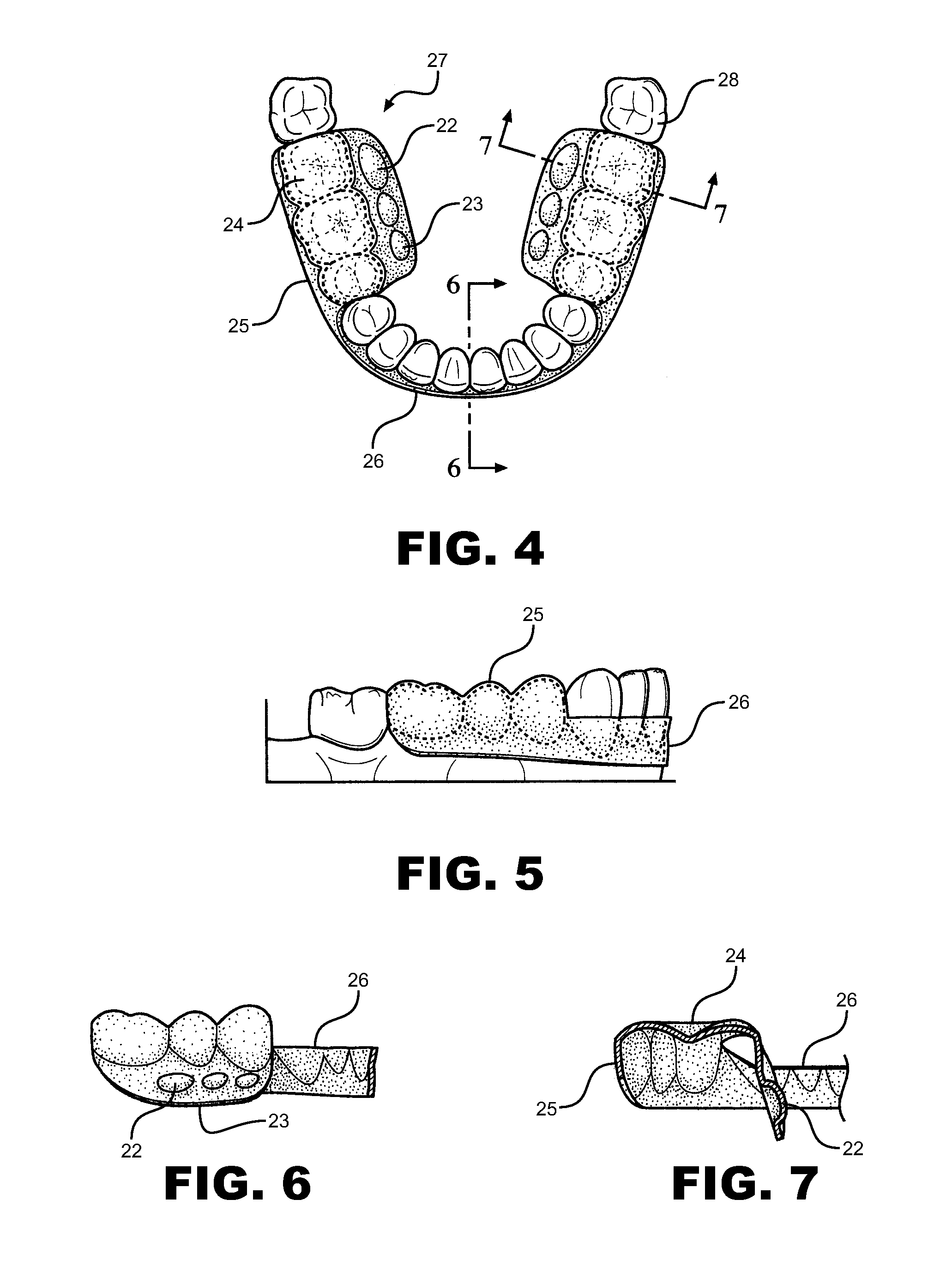 P3 Personal Power and Performance Mouthpiece