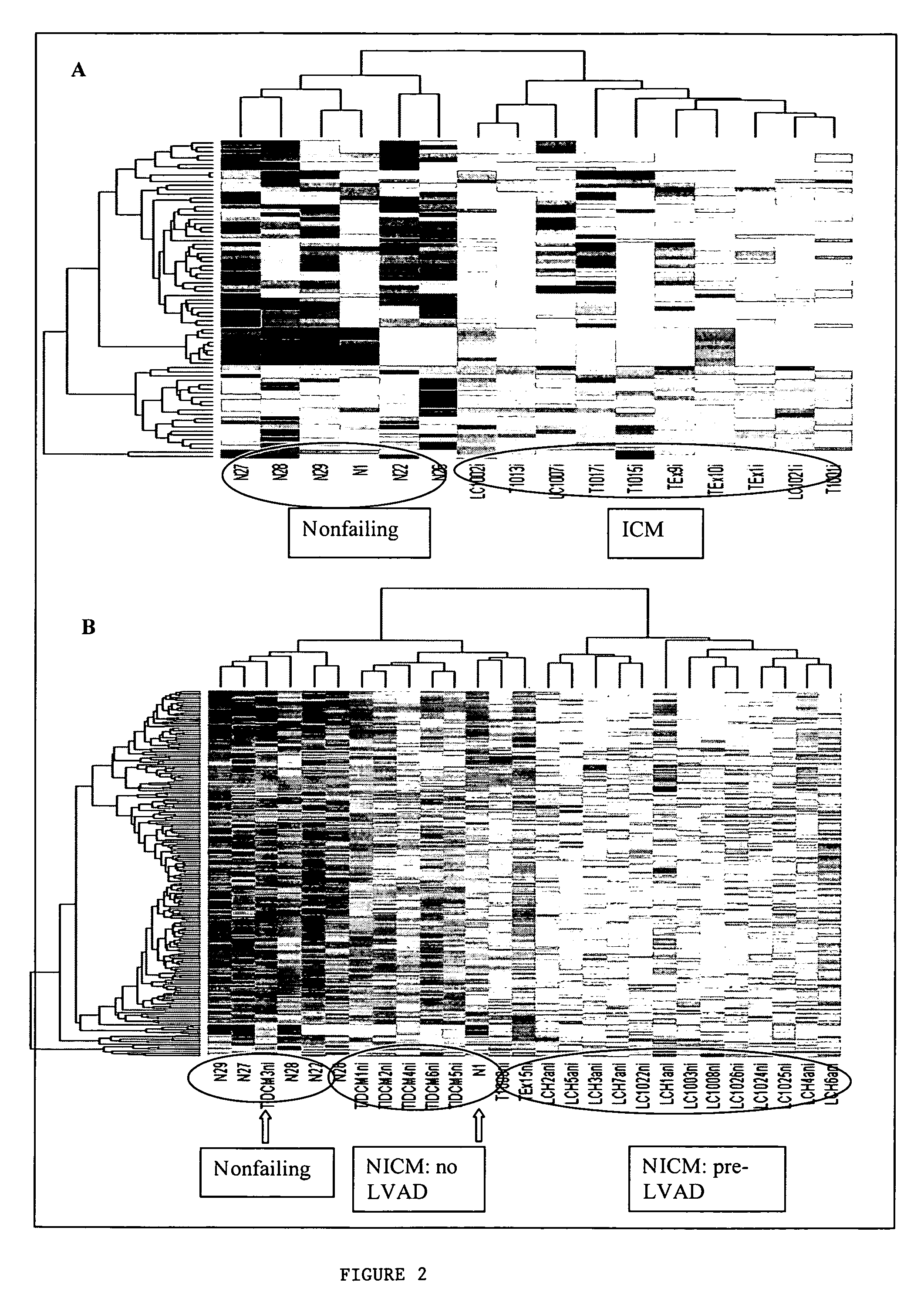 Identification of gene expression by heart failure etiology