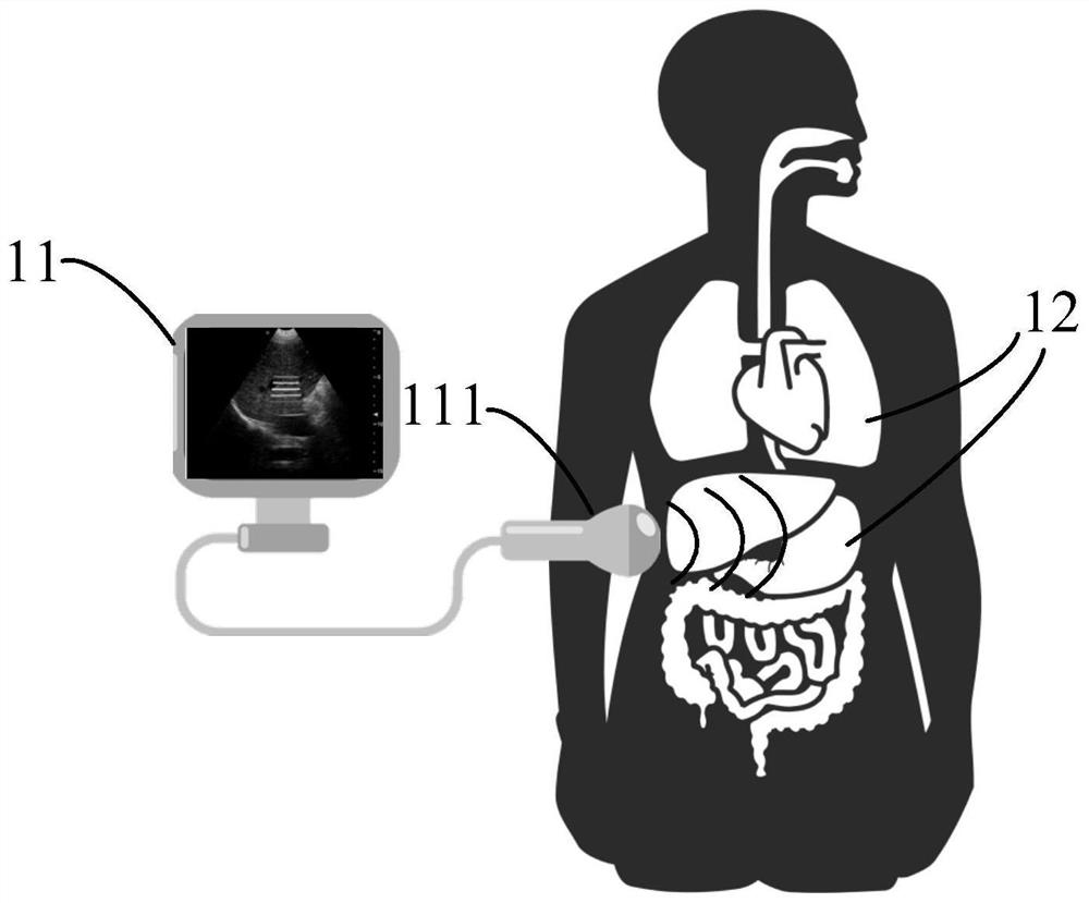 Elastic imaging method and device, electronic equipment and storage medium