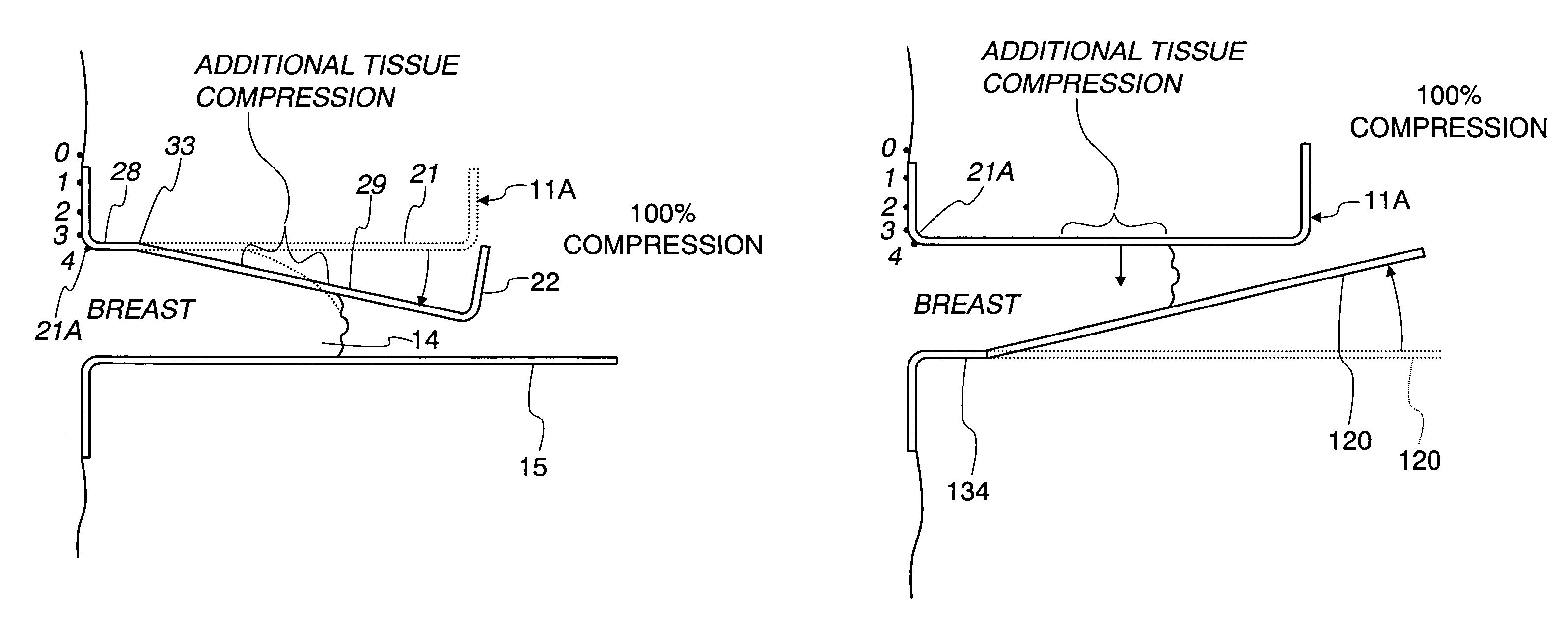 Method and apparatus for x-ray mammography imaging