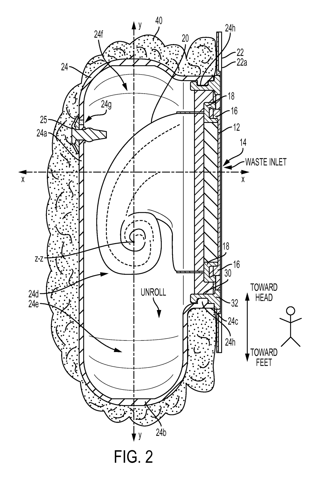 Ostomy appliance