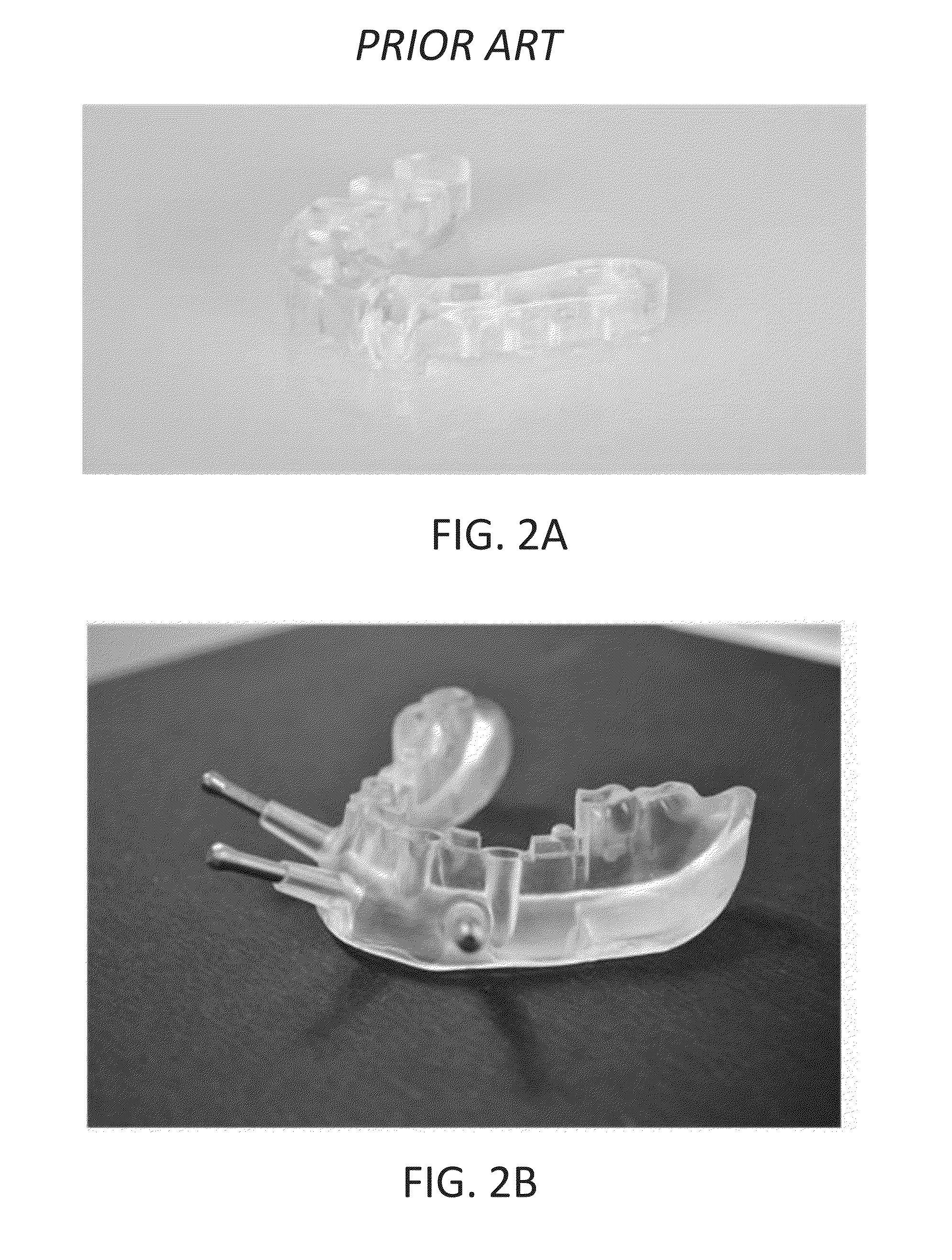 Dental device comprising surgical template and false teeth set and related methods