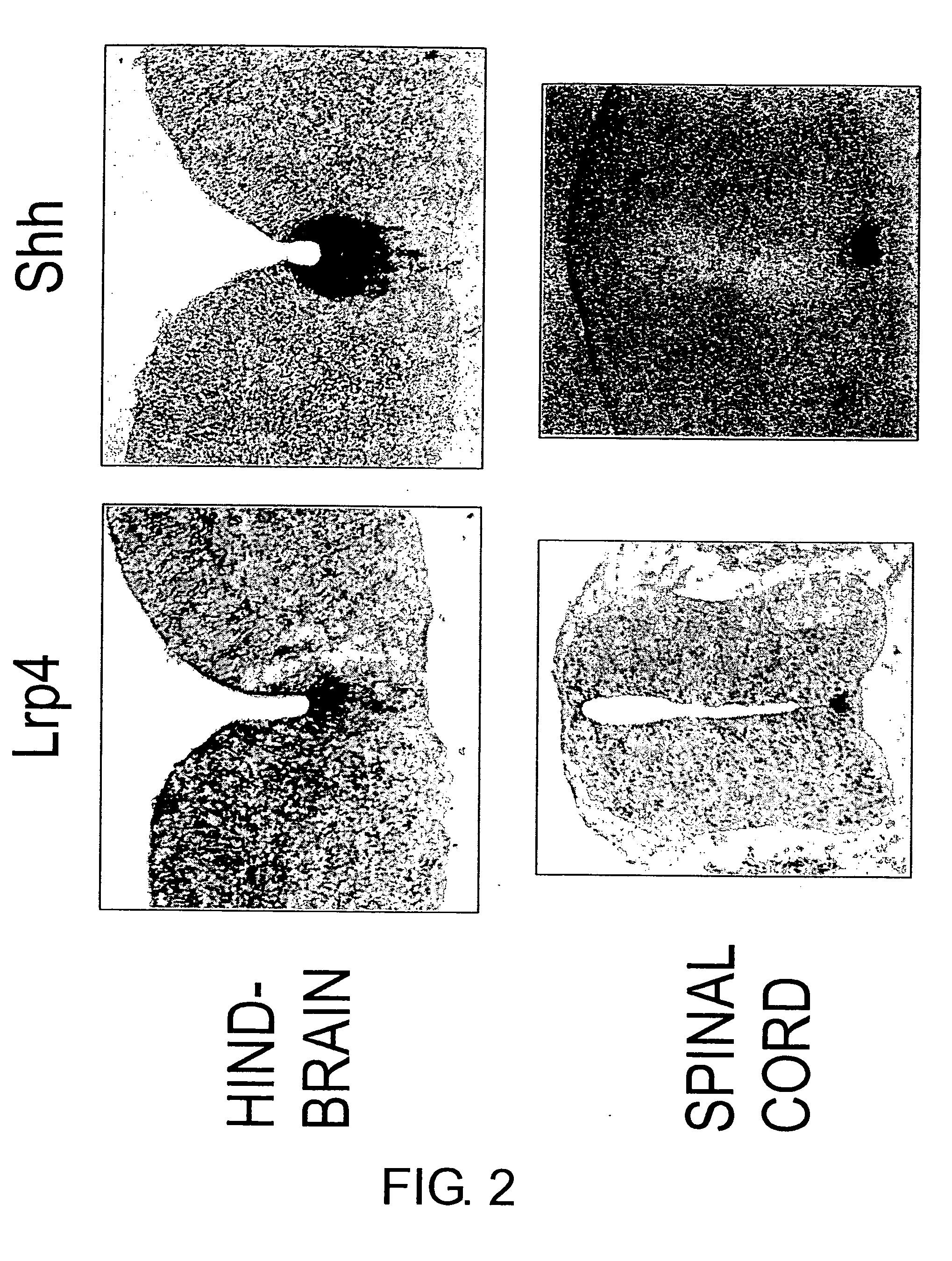 Lrp4/Corin Dopaminergic Neuron Progenitor Cell Markers