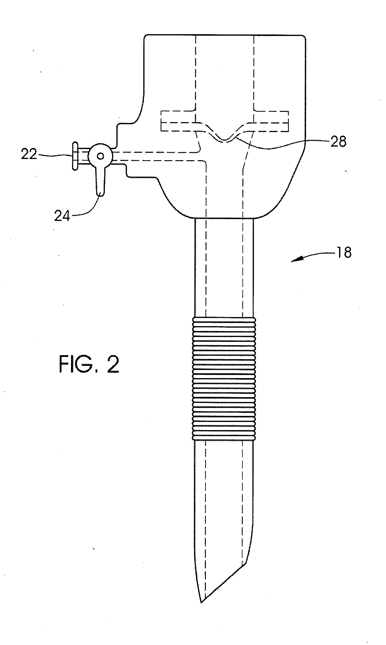 Method and apparatus for adjusting a gastrointestinal restriction device