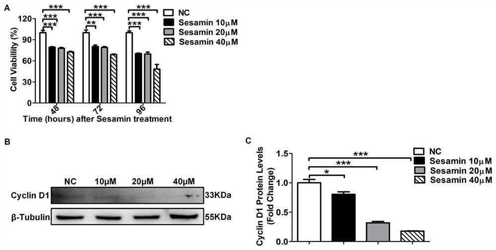 Application of sesamin in preparation of product for treating and/or preventing lymphoma