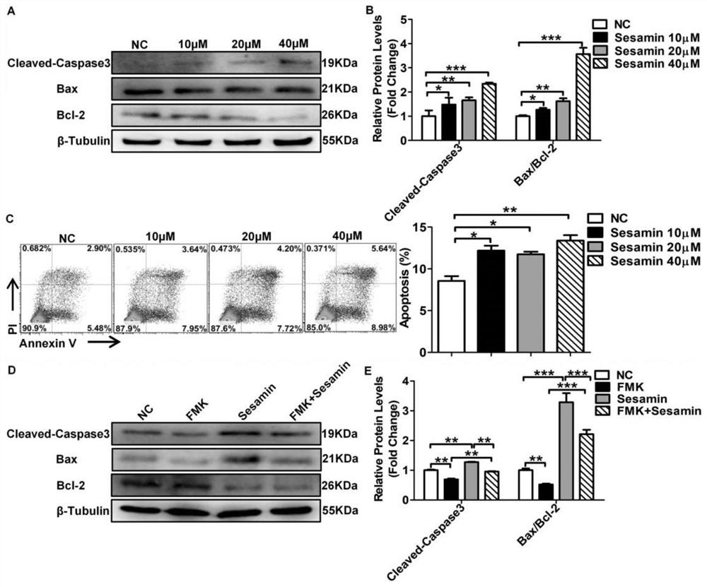 Application of sesamin in preparation of product for treating and/or preventing lymphoma