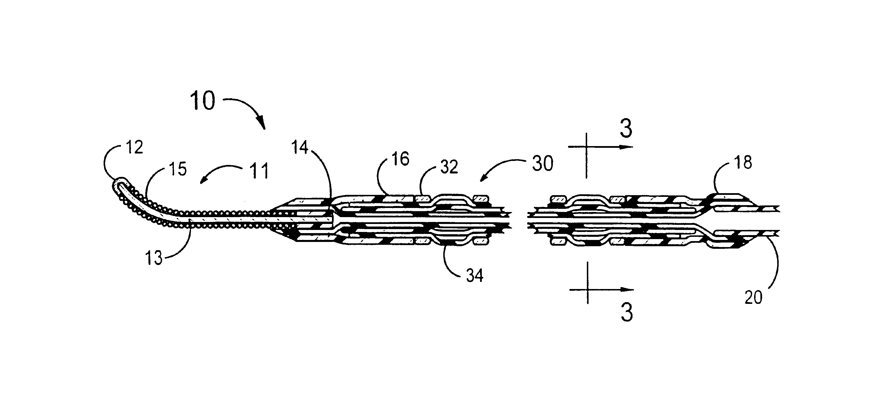Stent delivery system having a fixed guidewire
