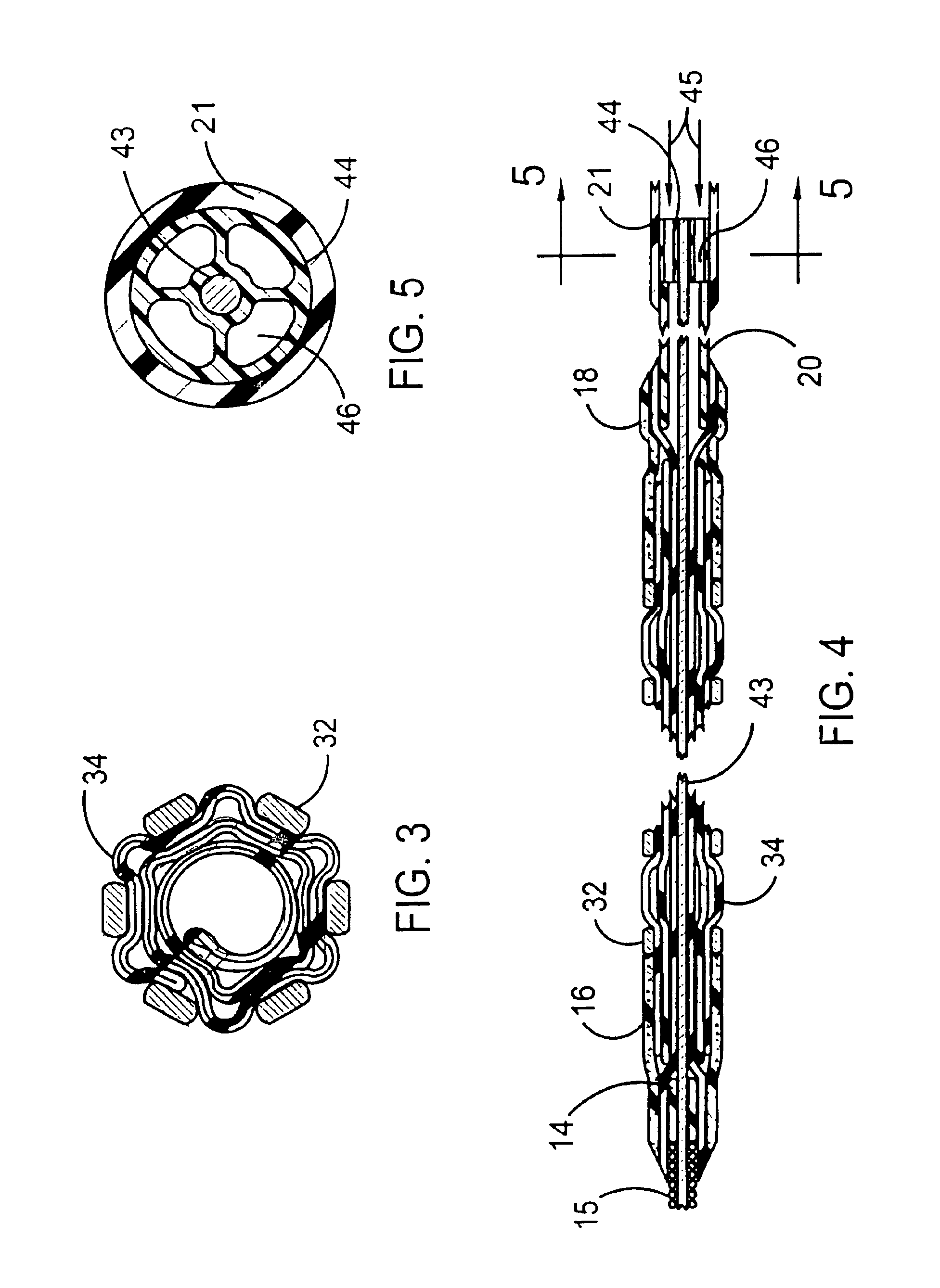 Stent delivery system having a fixed guidewire