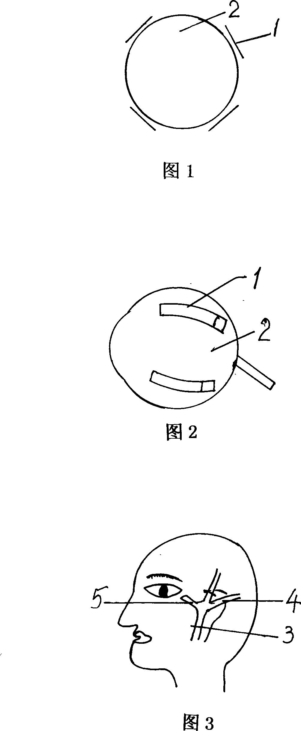 Method for treating pigmentary degeneration of retina