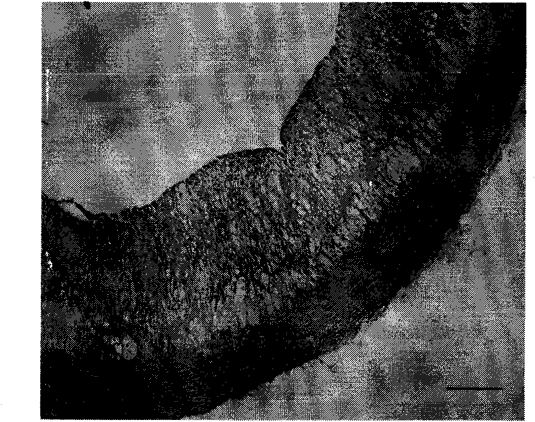 Drug combination containing raloxifene and application thereof