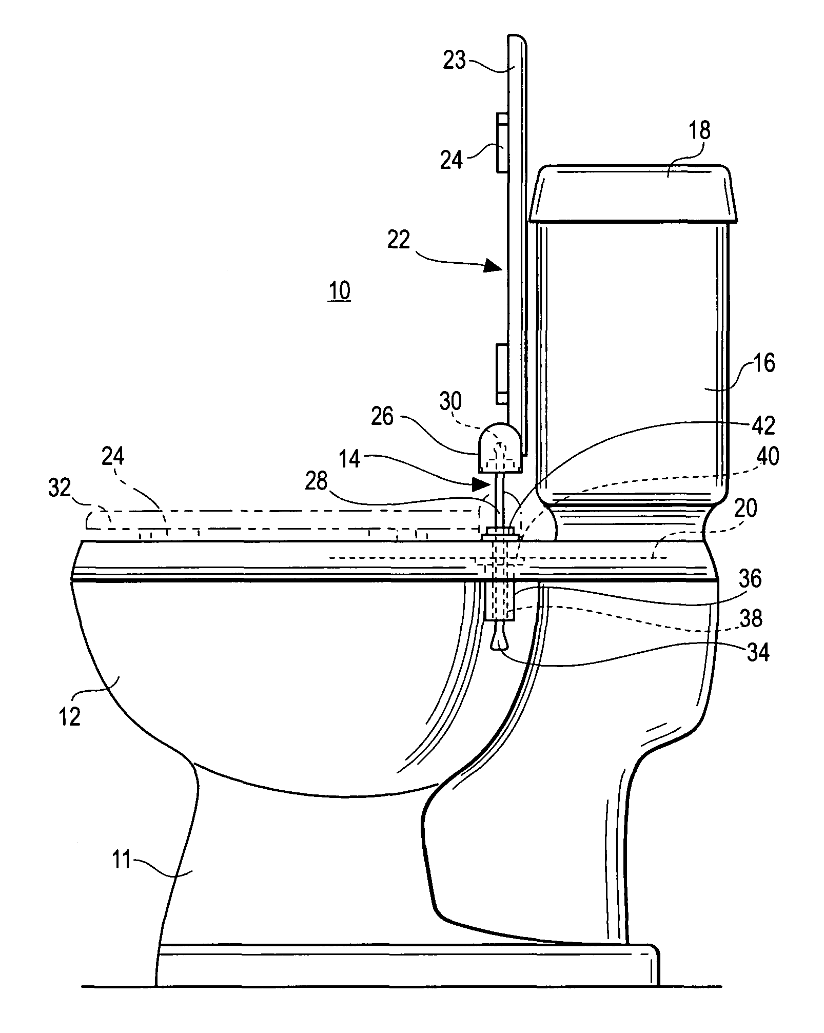 Toilet and toilet seat mounting system