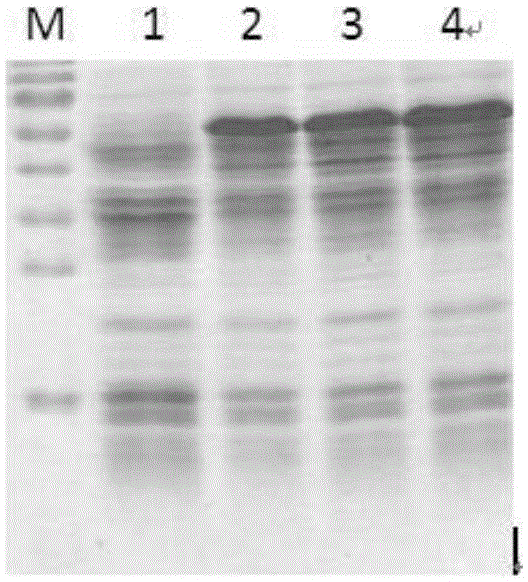 Recombinant human autoantigen Scl-70