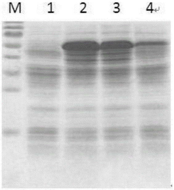 Recombinant human autoantigen Scl-70