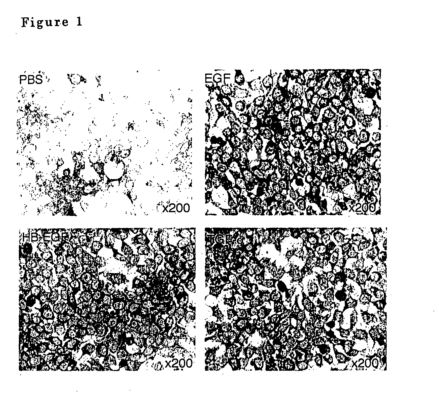 Airway-specific trypsin-like enzymes and method of using the same