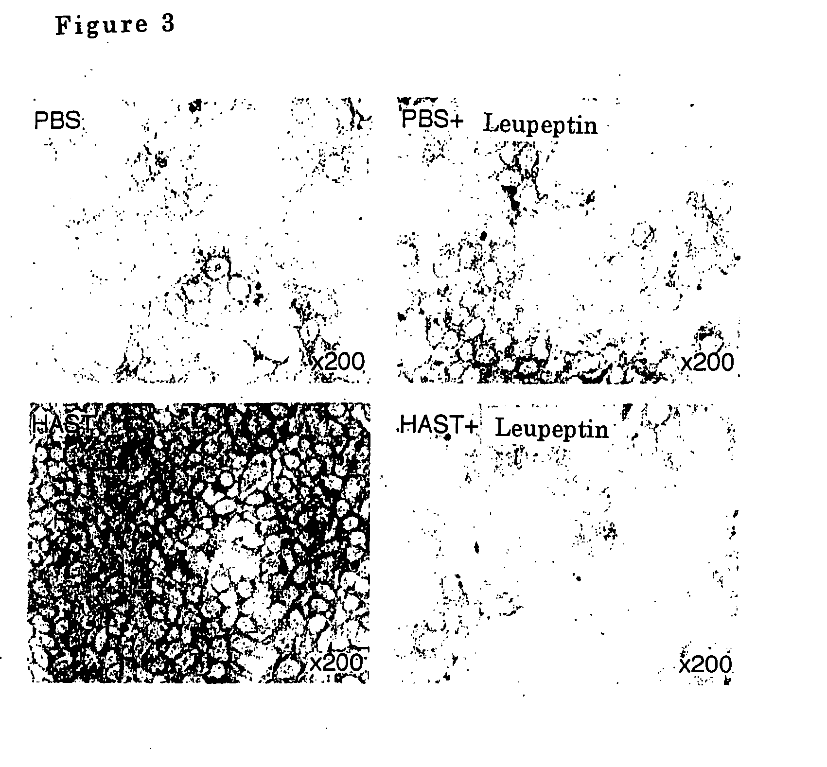 Airway-specific trypsin-like enzymes and method of using the same