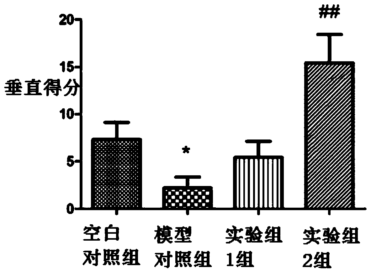 Application of nadph in the preparation of anti-anxiety drugs