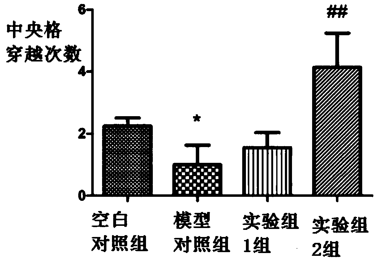 Application of nadph in the preparation of anti-anxiety drugs