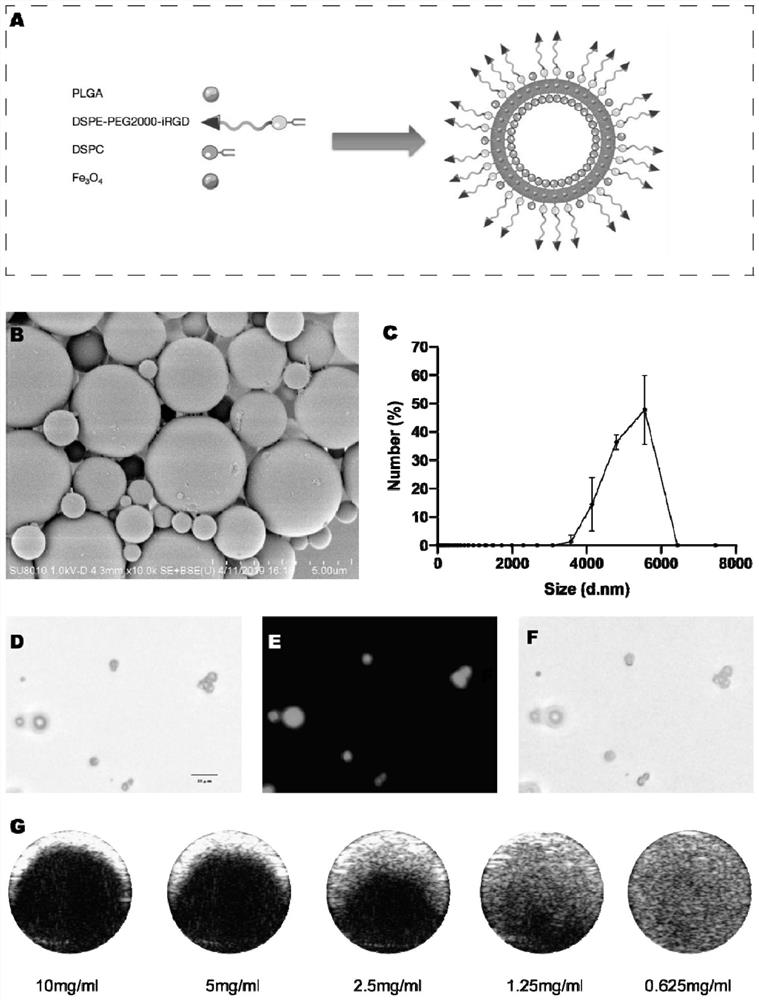 iRGD magnetic targeting microbubble contrast agent and application thereof