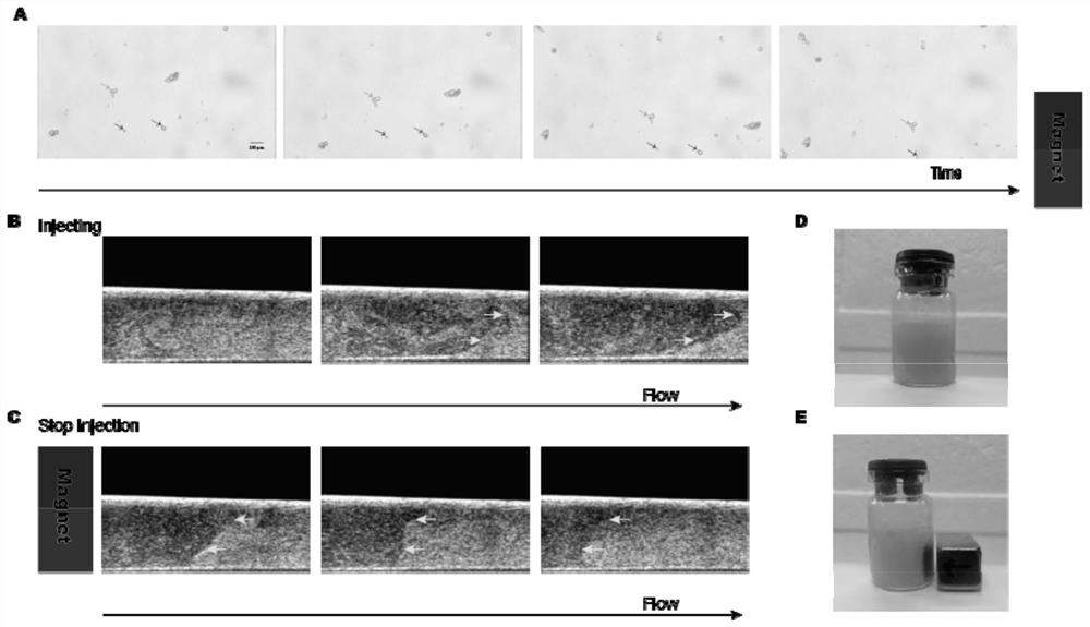 iRGD magnetic targeting microbubble contrast agent and application thereof