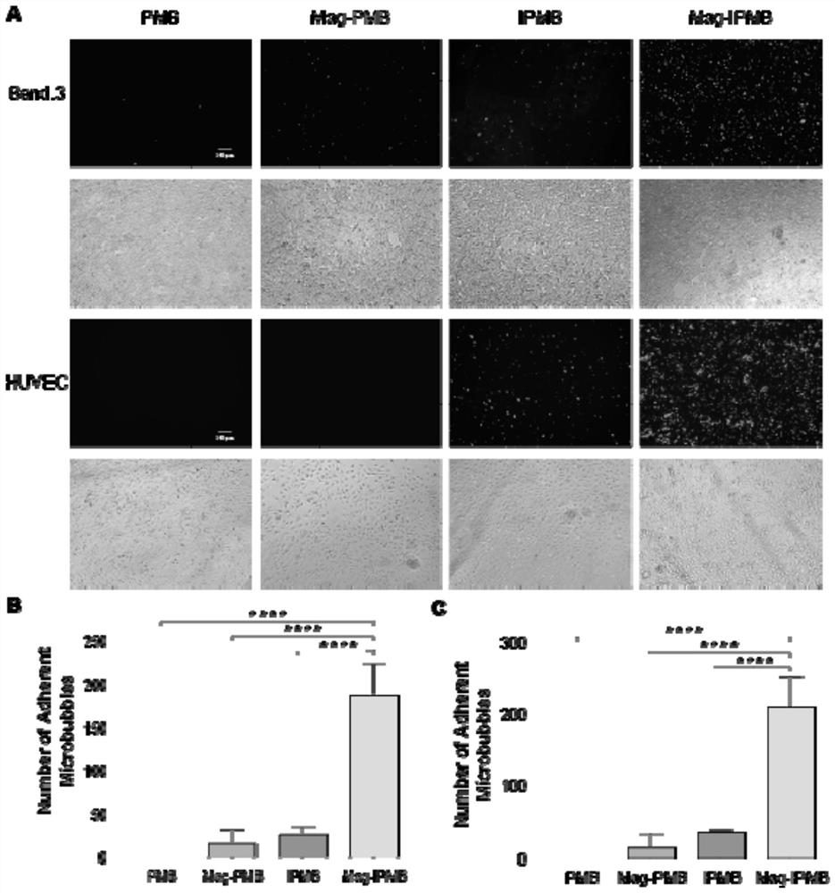 iRGD magnetic targeting microbubble contrast agent and application thereof