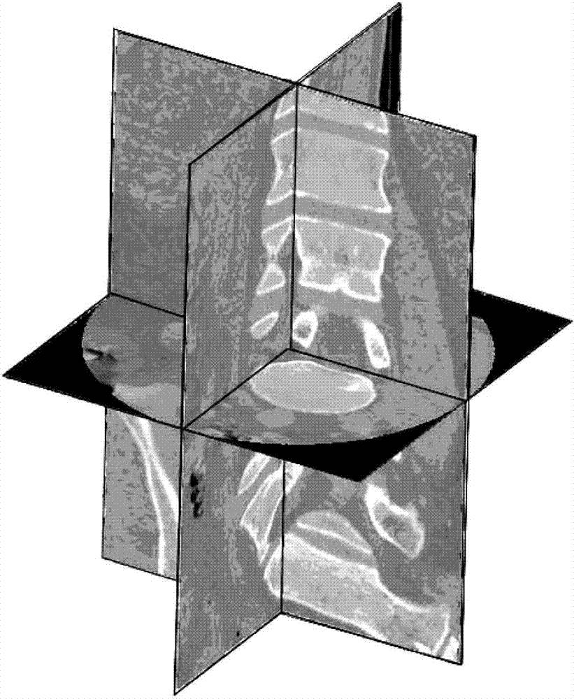 Double safety and effectiveness inspection method of human lumbar bone and implant